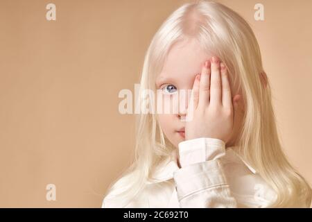 Albino. Cute kaukasischen kleines Mädchen mit Albinismus-Syndrom, schloss sie ein Auge und schauen Sie sich die Kamera. Natürliche Schönheit und Menschen Vielfalt Konzept Stockfoto