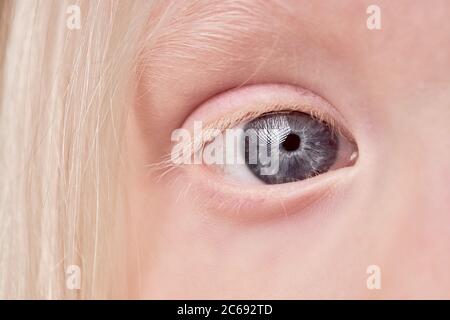 Close-up mystische Foto von Albino Kinderauge, Kind Mädchen mit ungewöhnlichen Augen Farbe. Natürliche Schönheit, Albinismus Konzept Stockfoto