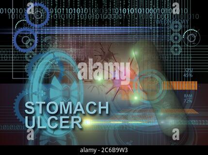 hi-Tech Infografiken von Magengeschwüren in 3d-Software gemacht Stockfoto