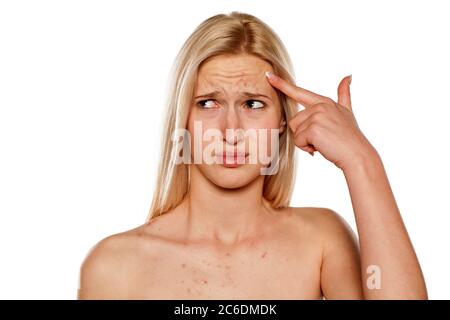 Traurige Blondine mit Pickel auf der Stirn und mit einem nachdenklichen Blick Stockfoto