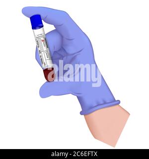 Hand in medizinischen Handschuh hält Reagenzglas mit Blutprobe für die Diagnose Covid 19 Virus. Positives Ergebnis für den Test Coronavirus 2019-nCoV. Realistisches 3d i Stock Vektor