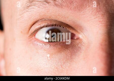 Tränende Augen Nahaufnahme Makroauge mit Träne tropft nach unten. Allergie-Saison und emotionale Reaktion. Stockfoto