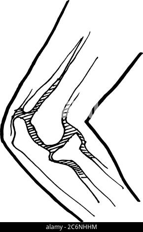 Konturvektor Umriss Zeichnung von menschlichen verletzten Knieknochen. Medizinische Design editierbare Vorlage Stock Vektor