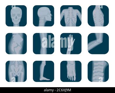 Vektor realistische X-ray Skelett Symbole gesetzt. Menschliche Skelett Röntgenelemente. Symbol für Körperteile Stock Vektor