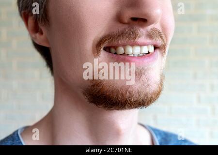 Bärtiger Mann mit rotem Bart aus nächster Nähe. In Quarantäne überwachsen. Stockfoto