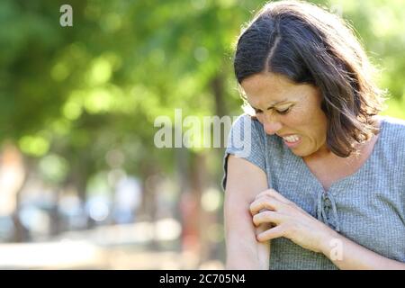 Erwachsene Frau mit juckender Haut Kratzer Arm im Park im Sommer stehen Stockfoto