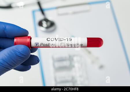 Arzt hält die Röhre mit Blut, das durch Coronavirus kontaminiert ist, mit dem Etikett Covid-19. Positive Analyse auf 2019-nCoV. Stockfoto