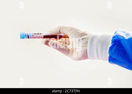 Corona Virus Blutteströhrchen auf weißem Hintergrund, Studioaufnahme. Blutproben. Diagnose und Labor. Stockfoto