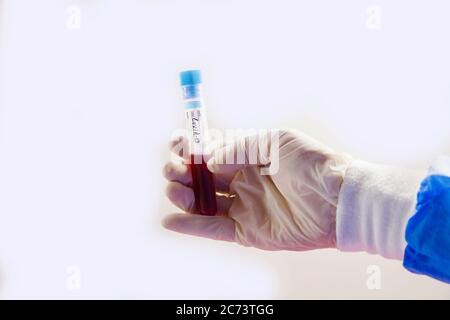 Corona Virus Blutteströhrchen auf weißem Hintergrund, Studioaufnahme. Blutproben. Diagnose und Labor. Stockfoto