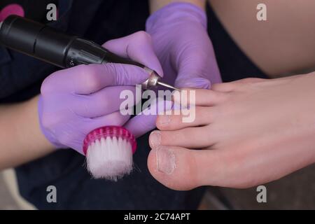 Verarbeitung Zehennägel, Pediküre. Handschuhen mit einem Pediküre-Cutter. Nahaufnahme Stockfoto