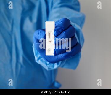 Nicht erkennbarer Arzt hält in der Hand positiven Test für Antikörper gegen Covid-19-Virus Stockfoto