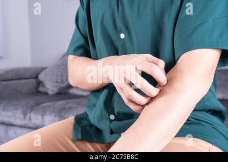 Junger Mann kratzt sich am Arm, während er zu Hause auf dem Sofa sitzt. Healthcare Medical oder Alltag Konzept. Stockfoto