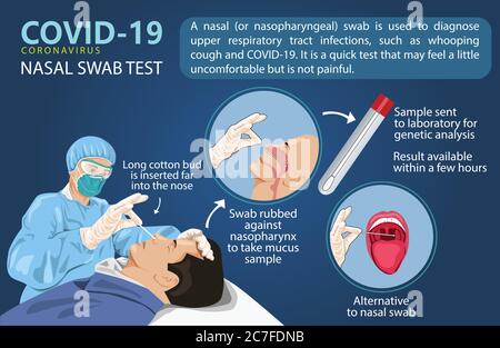 Ein Mann wird für einen Covid-19-Test abstricht. Um Corona-Virus-Tests zu beschleunigen, eine neue Art von Nasenabstrich. Info Grafik Vektor Illustration kreativ. Stock Vektor