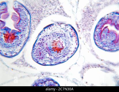 Hydatide Zysten der Bandwurm im Dog, TS. hellfeld photomicrograph Stockfoto