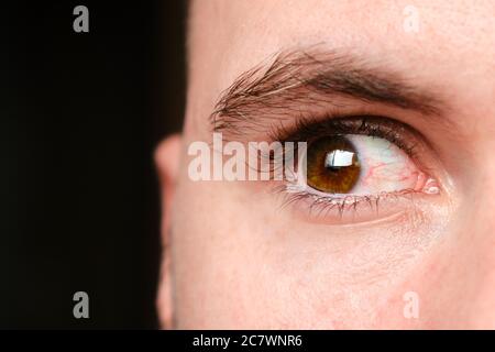 Nahaufnahme mans Blutbild oder rote Augen auf schwarzem Hintergrund, verursacht durch Konjunktivitis, Allergie oder Müdigkeit . Konzept der Gesundheitsversorgung mit Kopierraum Stockfoto