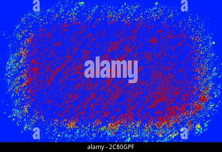 corona Virus unter mikroskopischer Sicht auf einem Glas Nahaufnahme Stockfoto