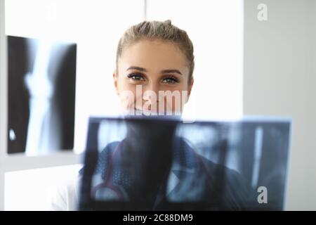 Ärztin im Büro hält eine Röntgenaufnahme in Nahaufnahme Stockfoto