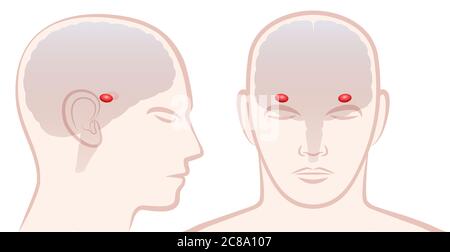 Amygdala. Profil und Frontalansicht mit Lage des Paares von Amigdalas im menschlichen Gehirn - Abbildung auf weißem Hintergrund. Stockfoto