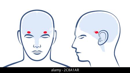 AMYGDALAE. Lage der beiden Amigdalas im menschlichen Gehirn. Profil und Frontalansicht mit Positionen - grafische Darstellung auf weißem Hintergrund. Stockfoto