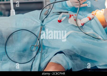 Horizontale Aufnahme einer Patientin auf dem Operationstisch im Operationssaal Team von Chirurgen im Krankenhaus arbeiten Menschen Vitalität Medizin Stockfoto