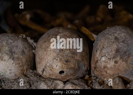 Schädel mit einem Einschussloch. Schädel und Knochen in Katakomben. Alter Schädel mit Loch auf den Knochen platziert. Unterirdischer Friedhof. Stockfoto