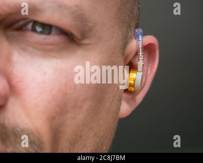 Hörgerät im Ohr eines Mannes mit Taubheit und Hörbehinderung. Stockfoto