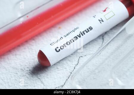 Covid-Teströhrchen mit positivem Blut auf dem Tisch, Nahaufnahme Stockfoto