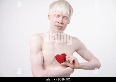 Albinismus Albino Mann im Studio gekleidet T-Shirt isoliert auf weißem Hintergrund. Abnorme Abweichungen. Ungewöhnliches Aussehen. Hautabnormität Stockfoto