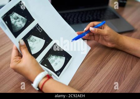 Der Arzt hält eine Ultraschalluntersuchung eines schwangeren Mädchens in der Hand. Hochwertige Fotos Stockfoto