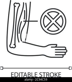 Lineares Symbol für Muskeldystrophie. Chronische genetische Störung. Gewebeschäden im menschlichen Arm. Dünne Linie anpassbare Illustration. Kontursymbol. Vektorisol Stock Vektor