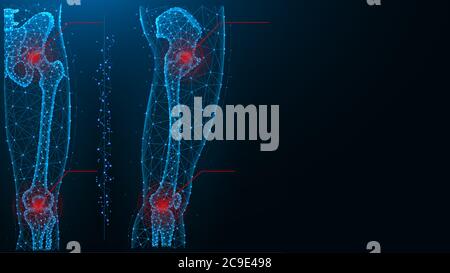 Schmerzen im Hüft- und Kniegelenk blaue polygonale Vektordarstellung Stock Vektor