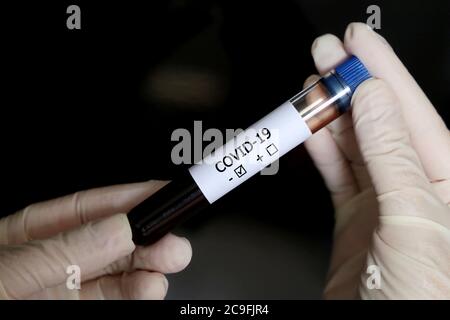 Teströhrchen mit Covid-19-Blutprobe in weiblichen Händen aus nächster Nähe. Arzt oder Wissenschaftler mit negativem Coronavirus-Test Stockfoto