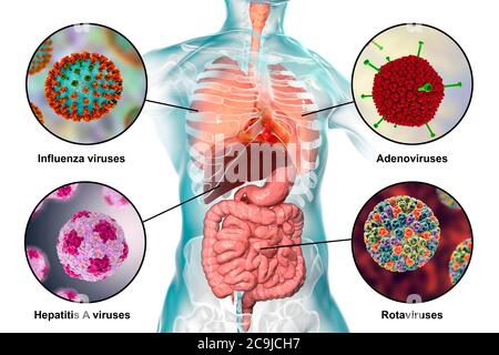 Humanpathogene Viren, die Infektionen der Atemwege und des Darminfektionen verursachen, Computerdarstellung. Influenza-Virus (oben links), Adenovirus (oben rechts), Antidense Stockfoto