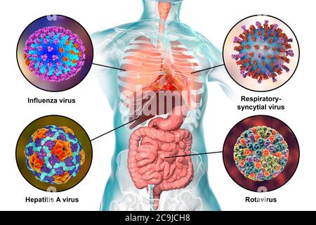 Humanpathogene Viren, die Infektionen der Atemwege und des Darminfektionen verursachen, Computerdarstellung. Influenzavirus (oben links), respiratorisch-synzytielles Virus (t Stockfoto