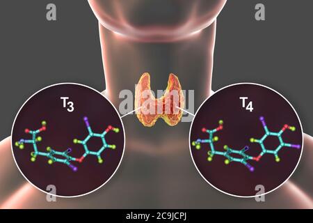 Moleküle der Schilddrüsenhormone Trijodthyronin (T3) und Thyroxin (T4), Computerdarstellung. Stockfoto