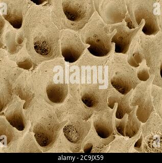 Zahn Dentin. Farbige Scanning Electron Micrograph (SEM) von Dentin (substantia Eburnea), mineralisierten Bindegewebe unter der Zahnschmelz gefunden Stockfoto
