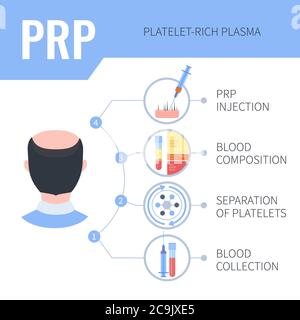 Thrombozytenreiches Plasma (PRP) Haar Nachwachsen Therapie bei Männern, Illustration. Stockfoto