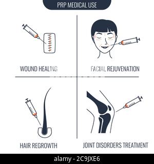 Thrombozytenreiches Plasma (PRP) medizinische Verwendung, Illustration. Stockfoto