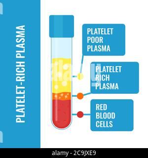 Thrombozytenreiches Plasma (PRP) Zusammensetzung, Illustration. Stockfoto