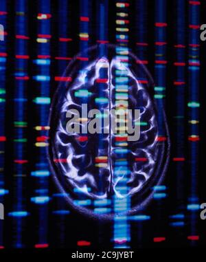 Genetische Forschung, konzeptuelles Bild. Mehrfachbelichtung eines DNA-Profils (Desoxyribonukleinsäure) und eines Hirnscans. Stockfoto