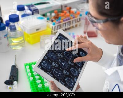 Wissenschaftler, die während eines Forschungsprojekts einen menschlichen Hirnscan auf einem Touchscreen betrachten. Stockfoto