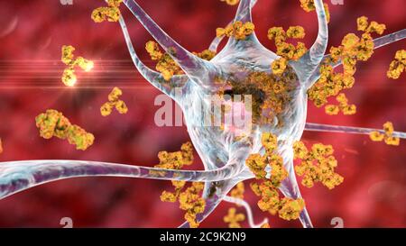 Antikörper gegen Neuronen. Konzeptionelle Computerdarstellung autoimmun neurologischer Erkrankungen. Stockfoto