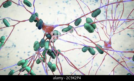 Bakterielle Enzephalitis. Konzeptionelle Computerdarstellung, die Bakterien zeigt, die Gehirnzellen infizieren. Stockfoto