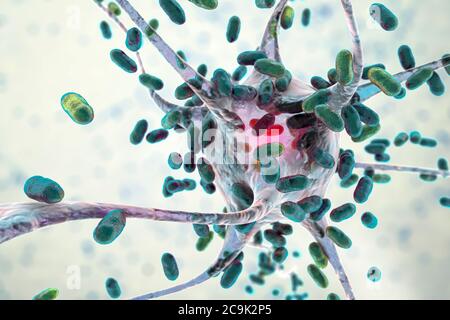 Bakterielle Enzephalitis. Konzeptionelle Computerdarstellung, die Bakterien zeigt, die Gehirnzellen infizieren. Stockfoto