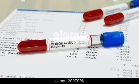 Negatives oder positives Testergebnis mit Schnelltestgerät für COVID-19, neuartiges Coronavirus 2019. 3d-Rendering Stockfoto