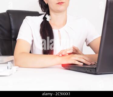 Das Mädchen im Büro hält während der Arbeit am Laptop das Handgelenk an der Hand. Konzept von Schmerzen und Entzündungen im Handgelenk, Arthritis und b Stockfoto