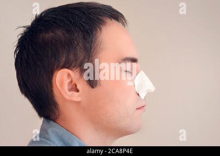 Der Mann zieht einen Streifen für die Nase von schwarzen Punkten an und entfernt ihn. Kohlereinigungsstreifen von Mitessern und Komedonen. Konzept der persönlichen Pflege. Stockfoto