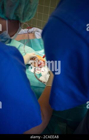 Zwei Ärzte führen eine Hämatomentfernung mit sterilen Handschuhen an einem Unterschenkel durch Stockfoto