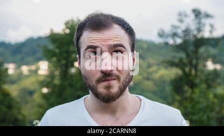 Junge weiße Haut schöner Mann mit instabilen Problemen in der Natur Stockfoto