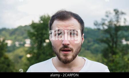 Junge weiße Haut schockiert Gesicht schöner Mann in der Natur Stockfoto